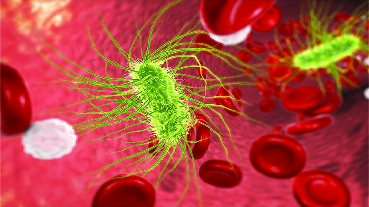 Sepsis-associated Acute Kidney Injury (AKI)